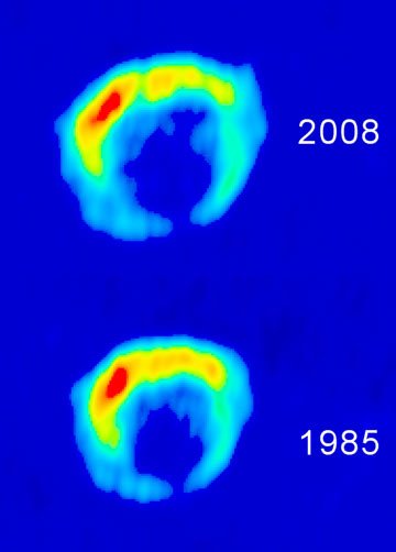 HST objavil najvzdialenejšiu supernovu